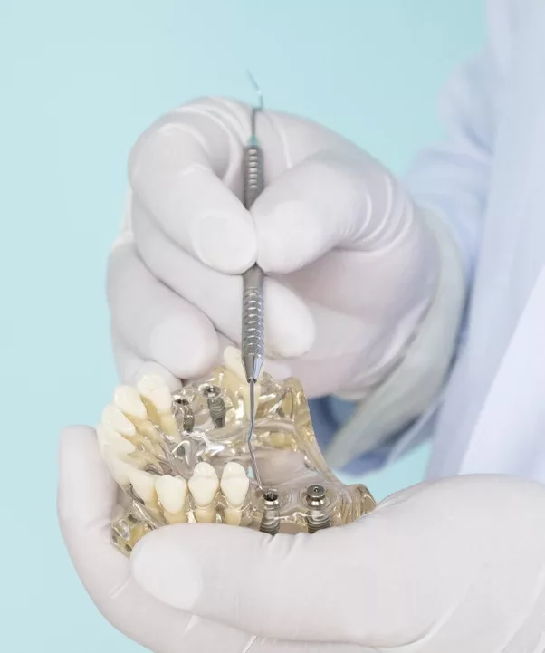 Implant dentaire en Tunisie