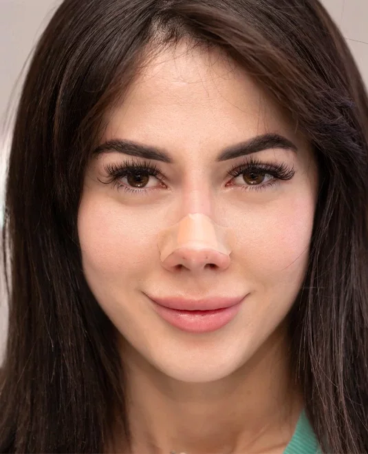 La rhinoplastie ethnique en Tunisie